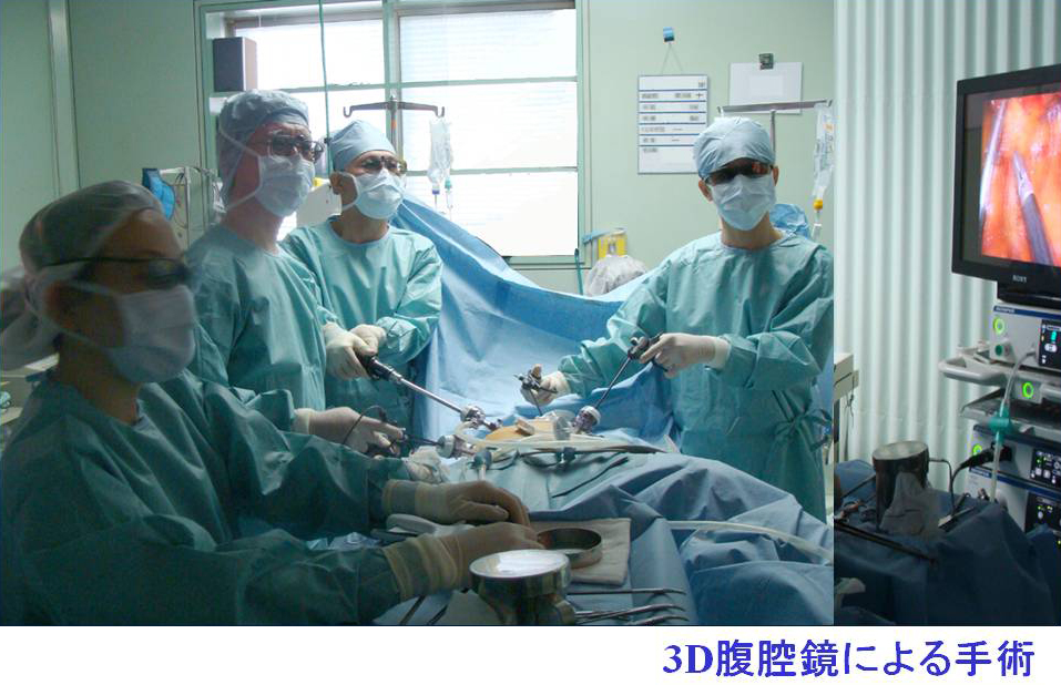 大腸がんの治療(手術)